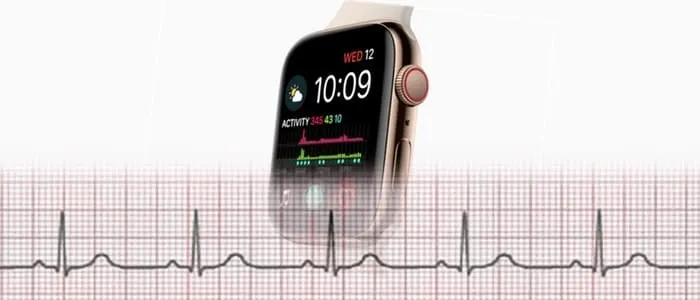 Electrocardiogram ECG at our Clinic vs. The Apple Watch ECG | Tel Aviv Doctor