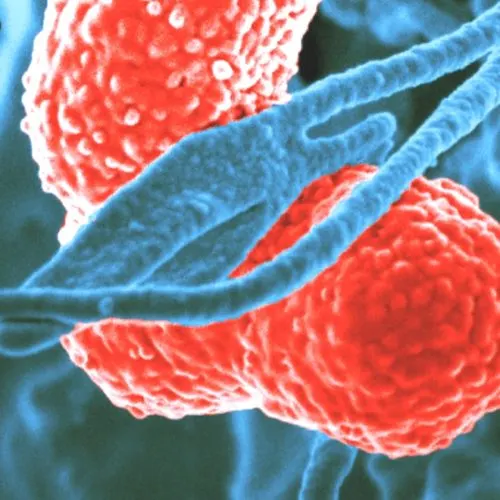 What is Sepsis – Medical Background and Warning Signs